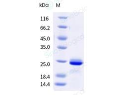 Sino Biological&nbsp;Recombinant Rat FGF-21 Protein (His Tag), HPLC-verified