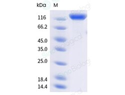 Sino Biological&nbsp;Recombinant Cynomolgus VEGFR2/KDR Protein (ECD, His & AVI Tag), Avi-tag Biotinylated, HPLC-verified