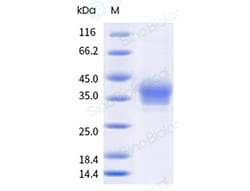 Sino Biological&nbsp;Recombinant Rat B7-H6/NCR3LG1 Protein (His Tag)