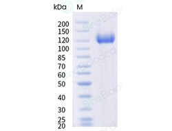 Sino Biological&nbsp;Recombinant Mouse Siglec-10 Protein (ECD, hFc Tag), HPLC-verified