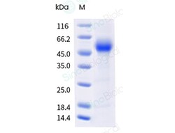 Sino Biological&nbsp;Recombinant Cynomolgus Siglec-6 Protein (ECD, His Tag)
