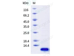 Sino Biological&nbsp;Bos taurus (Bovine) Aprotinin Protein (HPLC-verified)