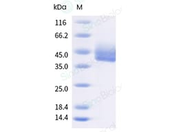 Sino Biological&nbsp;Recombinant Canine CD64/FCGR1 Protein (His Tag), HPLC-verified