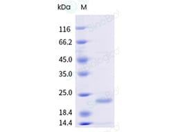 Sino Biological&nbsp;Recombinant Human Claudin-4/CLDN4 Protein (Nanodisc, Full-length, Avi & His Tag), Avi-tag Biotinylated