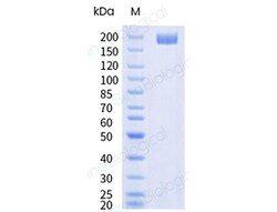 Sino Biological&nbsp;Recombinant Cynomolgus L1CAM Protein (His Tag), HPLC-verified