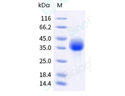 Sino Biological Cynomolgus ASGR1 1mg