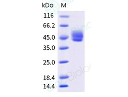 Sino Biological&nbsp;Recombinant Rhesus CD64/FCGR1 Protein (His & AVI Tag), Biotinylated, HPLC-verified
