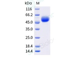 Sino Biological BVDV BVDVE2 250ug, Quantity: Each of 1