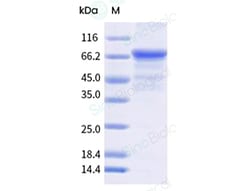 Sino Biological&nbsp;Recombinant Bovine viral diarrhea virus (BVDV) p80 antigen