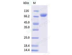 Sino Biological Recombinant Cynomolgus, Rhesus TL1A/TNFSF15 Protein (His Tag), Trimer, MALS-verified