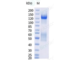 Sino Biological&nbsp;Recombinant Cynomolgus Insulin Receptor Protein (ECD, His Tag), HPLC-verified