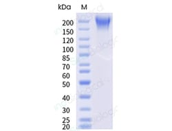Sino Biological&nbsp;Recombinant Mouse SEZ6 Protein (ECD, His Tag), HPLC-verified