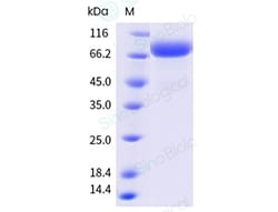 Sino Biological&nbsp;Influenza A H1N1 (A/California/07/09) Hemagglutinin / HA trimer Protein (His & AVI Tag), Biotinylated
