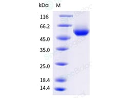 Sino Biological&nbsp;Recombinant Human APRIL/TNFSF13 Protein (AVI & His Tag), Avi-tag Biotinylated, MALS-verified