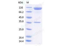 Sino Biological&nbsp;Recombinant Human Angiopoietin-2/ANGPT2 Protein (mFc Tag)