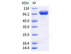 Sino Biological Influenza A H1N1 (A/California/04/2009) Hemagglutinin / HA trimer Protein (His Tag) (MALS-verified)