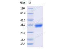 Sino Biological&nbsp;Recombinant Human JAM-A/F11 Receptor Protein (His & AVI Tag), Avi-tag Biotinylated, HPLC-verified