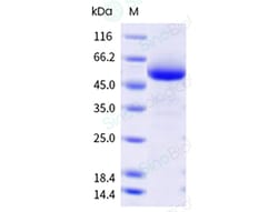 Sino Biological&nbsp;Recombinant Human APRIL/TNFSF13 Protein (Trimer, His Tag), MALS-verified