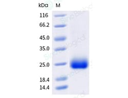 Sino Biological&nbsp;Recombinant Human PGRP-S/PGLYRP1 Protein (His Tag), Biotinylated