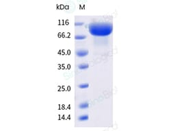 Sino Biological&nbsp;Recombinant Human CD10/Neprilysin Protein, Biotinylated