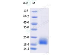 Sino Biological&nbsp;Recombinant Cynomolgus TSPAN8 Protein (AVI & His Tag), Avi-tag Biotinylated