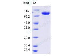 Sino Biological Recombinant Cynomolgus Desmoglein-2 Protein (ECD, His Tag), HPLC-verified