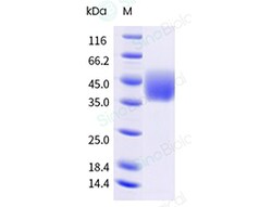 Sino Biological&nbsp;Recombinant Cynomolgus Growth Hormone Receptor Protein (His Tag), HPLC-verified