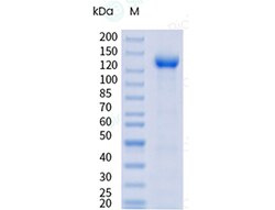 Sino Biological Cynomolgus CDH17 100ug