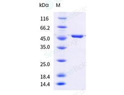Sino Biological&nbsp;Recombinant Cynomolgus PAH Protein (His Tag)