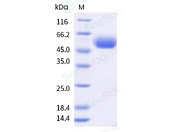 Sino Biological&nbsp;Recombinant Cynomolgus KIR3DL3 Protein (His Tag)
