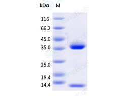 Sino Biological&nbsp;Recombinant Canine FCGRT & B2M Heterodimer Protein (His & AVI Tag), Avi-tag Biotinylated, HPLC-verified