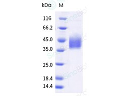 Sino Biological&nbsp;Coxsackievirus (CV) A6 VP1 Protein (His Tag)