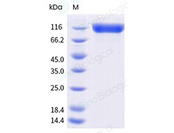 Sino Biological&nbsp;Recombinant Mouse VEGFR2/KDR Protein (ECD, His & AVI Tag), Avi-tag Biotinylated, HPLC-verified