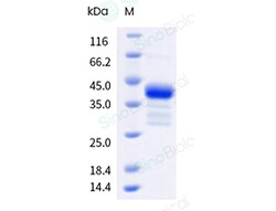 Sino Biological&nbsp;Yellow fever virus (YFV) (strain 17D vaccine) Envelope Protein (His Tag)
