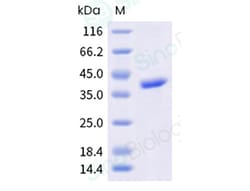 Sino Biological&nbsp;Recombinant Penicillium chrysogenum Pen n 18 Protein