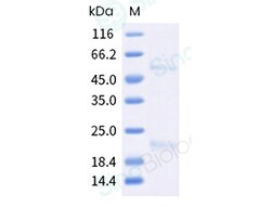 Sino Biological&nbsp;Recombinant Human Claudin-4/CLDN4 Protein (Nanodisc, Full Length, His & Strep Tag)