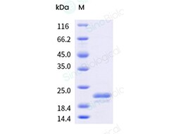 Sino Biological&nbsp;Recombinant Human Claudin-4/CLDN4 Protein (Detergent, Full-length, Flag Tag)