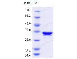 Sino Biological&nbsp;Recombinant Mycoplasma pneumoniae P116-C1