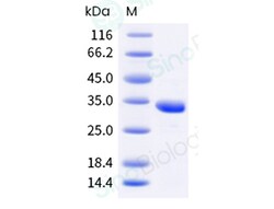 Sino Biological Mycoplasma pneumoniae mgpA 250