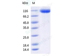 Sino Biological&nbsp;Recombinant Human FCRL5 Protein (ECD, His Tag), HPLC-verified