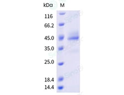 Sino Biological&nbsp;Recombinant Human C5AR1/C5R1/CD88 Protein (Nanodisc, thermostabilizing mutations, Flag-Strep & His tag)