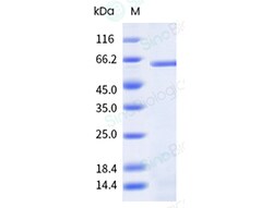 Sino Biological Human VIM 1mg