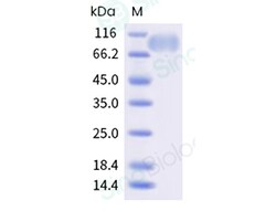 Sino Biological&nbsp;Recombinant Human CD42b/GP1BA Protein (His Tag), Amine-Labeled Biotinylated