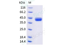 Sino Biological&nbsp;Recombinant Rat CD25/IL-2R alpha Protein (ECD, His & AVI Tag), Avi-tag Biotinylated
