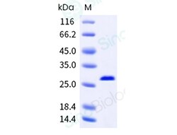 Sino Biological Mycoplasma pneumoniae p30 250u
