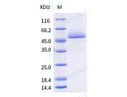 Sino Biological&nbsp;Recombinant Human CD9 Protein (Nanodisc, Full-length, His-GFP Tag), Fluorescent