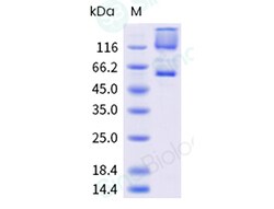 Sino Biological&nbsp;Recombinant Human CRBN & DDB1 Heterodimer Protein (His & FLAG Tag)