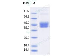 Sino Biological Cynomolgus / Rhesus CD64/FCGR1  Protein (His Tag)