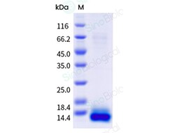 Sino Biological&nbsp;Recombinant Cynomolgus ITPRIPL1 Protein (ECD, His Tag), HPLC-verified