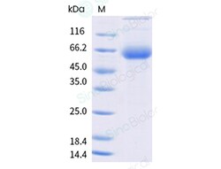 Sino Biological&nbsp;Rabies virus (RABV) Glycoprotein/G Protein (MALS-verified)